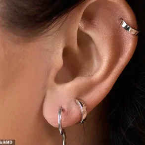 Viral Advice from Dr. Sam Ellis: Why Wearing Earrings to Bed Could Reshape Anti-Ageing Routines