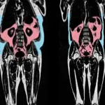 Danish Study Finds Underweight Linked to Higher Mortality Risk Than Overweight, Prompting Reevaluation of Health Guidelines
