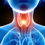 Early Detection of Thyroid Cancer Highlights Importance of Medical Consultation and Vigilance